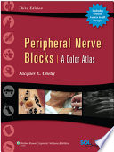 Peripheral nerve blocks a color atlas