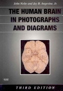 The human brain in photographs and diagrams