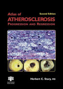 Atlas of atherosclerosis progression and regression