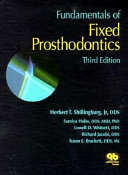 Fundamentals of fixed prosthodontics