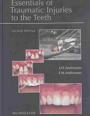 Essentials of traumatic injuries to the teeth a step-by-step treatment guide