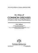 An atlas of common diseases a guide to their visual manifestations