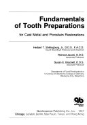 Fundamentals of tooth preparations for cast metal and porcelain restorations